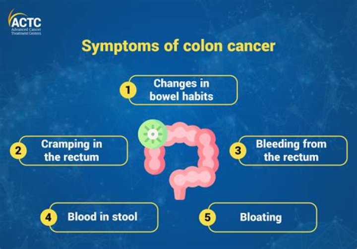 Colorectal Cancer Breakthroughs In Colocobm