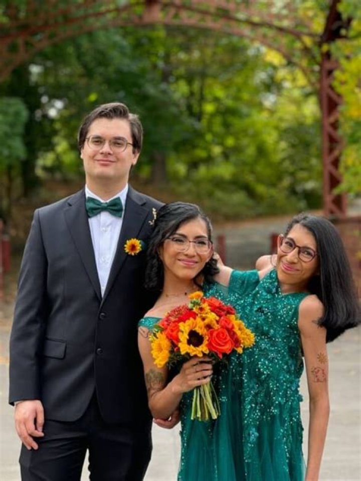 Conjoined Twins Find Love And Marriage