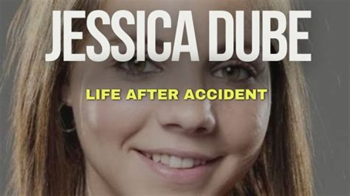 Discover Jessica Dube's Scar Transformation: Insights And Uncovered Stories