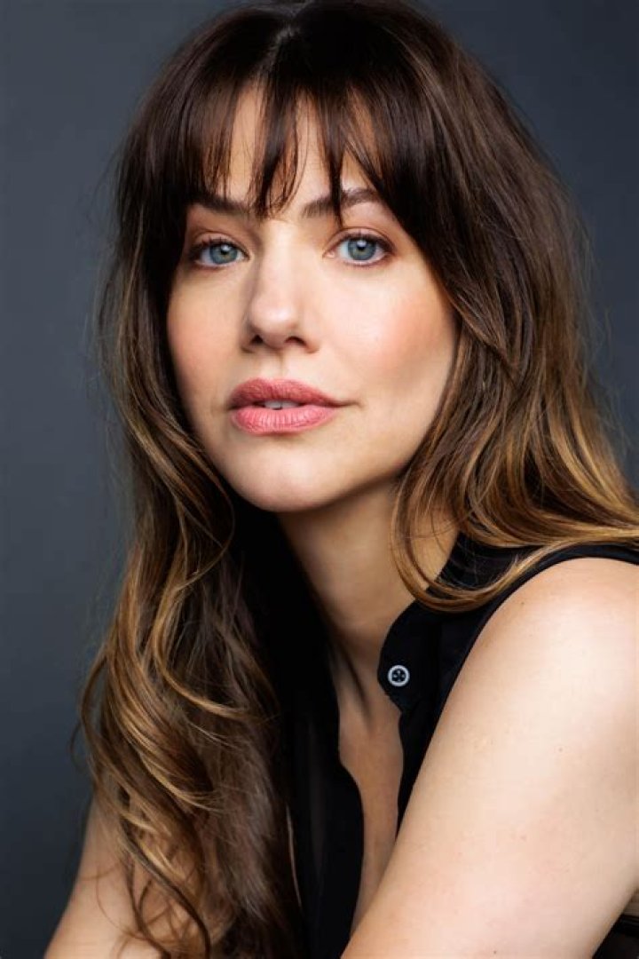 Julie Gonzalo's Scar And Its Untold Truths