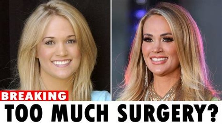 Kimberly Guilfoyle's Cosmetic Surgery Journey: Uncovering The Truths