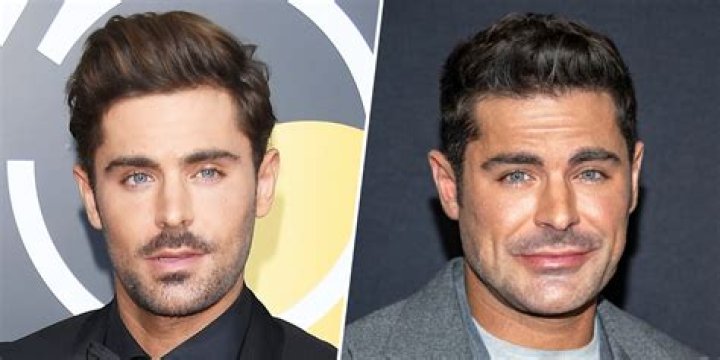 Unlocking The Enigma: Zac Efron's Eye Infection