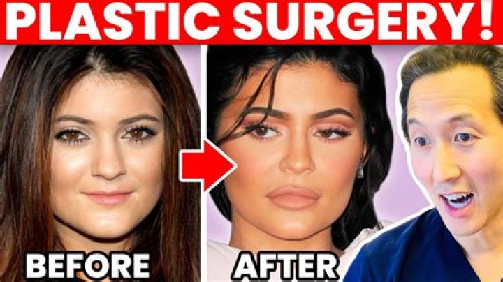 Unveiling Kiaraakitty Plastic Surgery: Discoveries And Insights