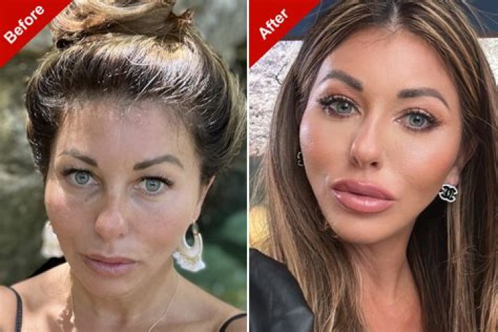 Unveiling Sarah Hyland's Cosmetic Surgery: A Journey Of Transformation