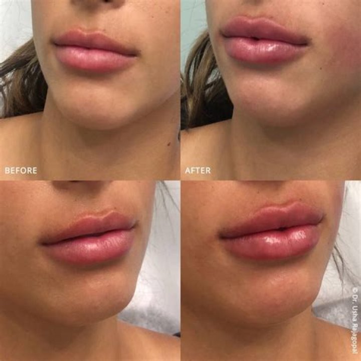 Unveiling The Allure Of Sarah Hyland's Iconic Lips: A Journey Into Beauty