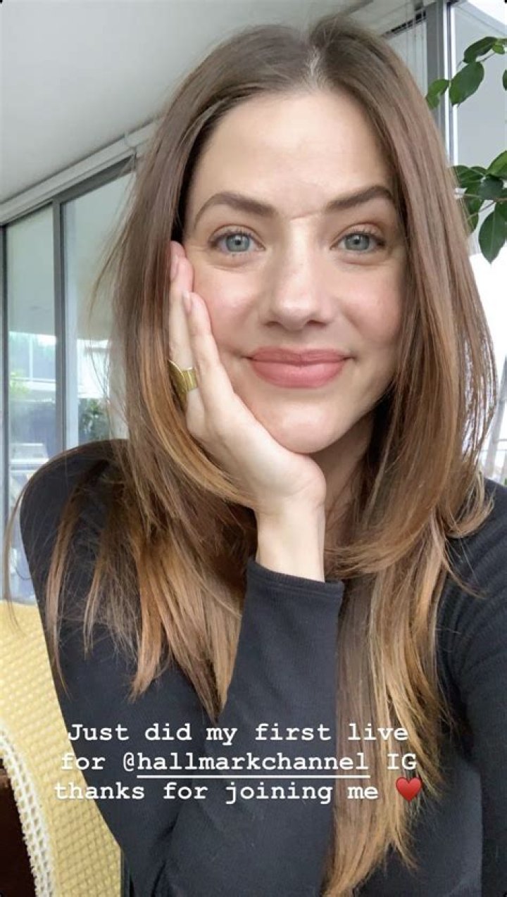 Unveiling The Story Behind Julie Gonzalo's Face Scar: Discoveries And Insights